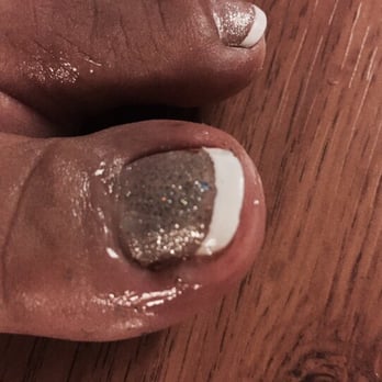 Sparkle Nail Bar - Nasty, painful infection the next day after a pedicure by a lady named Lily. She likely didn't sterilize her tools. Horrible. - Nail Salons Near Me - Elk Grove, California Sparkle Nail Bar - Nasty, painful infection the next day after a pedicure by a lady named Lily. She likely didn't sterilize her tools. Horrible. - Nail Salons Near Me - Elk Grove, California
