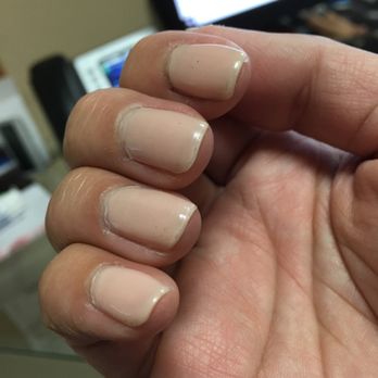 Krazy Nails - Polish is chipping on 3 fingers and thumb - Nail Salons Near Me - Peoria, Arizona Krazy Nails - Polish is chipping on 3 fingers and thumb - Nail Salons Near Me - Peoria, Arizona
