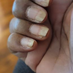 My nails after having them done for months at Noble Nails...BEWARE! My nails after having them done for months at Noble Nails...BEWARE!