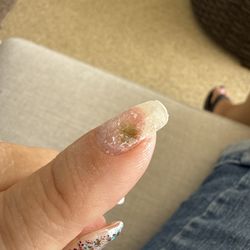 Huge fungus spot! After only a few days is completely unacceptable. Not going back!