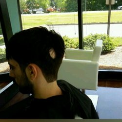 #2 back and sides blended with scissors on top to cover the problem area.