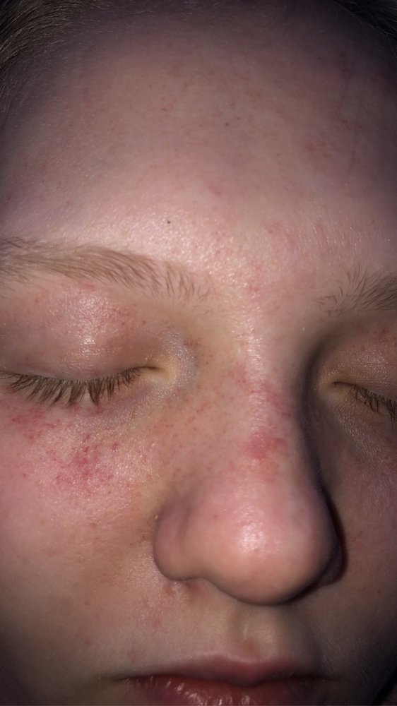 ROTTIES, REHAB & RESCUE Updated September 2024 Shickshinny