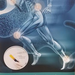 TOTAL ORTHOPAEDIC CARE - 10 Photos & 30 Reviews - Orthopedists - 4850 W