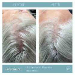 Wesley Chapel Laser and Aesthetics
