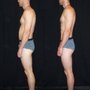 Stephanie Brossard Rolfing Structural Integration
