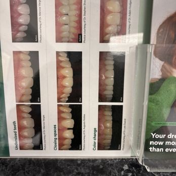 Carson Dental - Teeth cleaning - General Dentistry Near Me - Carson, California Carson Dental - Teeth cleaning - General Dentistry Near Me - Carson, California