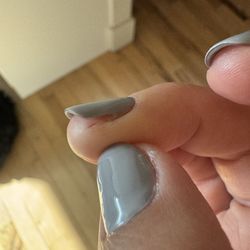 Nails 208 - Cuts from manicure