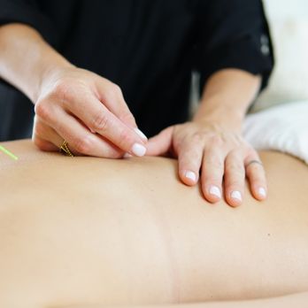 Arise Acupuncture - Acupuncture Near Me - San Diego, California Arise Acupuncture - Acupuncture Near Me - San Diego, California