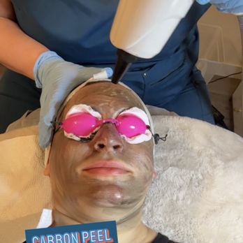 Universal Beauty Zone - Facial included Carbon peel - Hair Salons Near Me Universal Beauty Zone - Facial included Carbon peel - Hair Salons Near Me