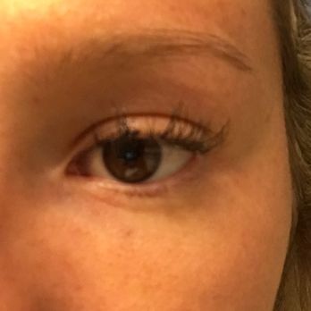 Lasers N Lashes - Day 3: My eyelashes were thin, separated, and falling out. It's been 7 days since and I can count the number of eyelashes left. - Eyelash Service Near Me - Westminster, Colorado