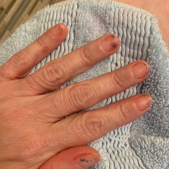 Orchid Nails & Spa - Ruined nails! - Hair Salons Near Me - Melbourne, Florida