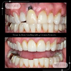Lafayette Dental Excellence