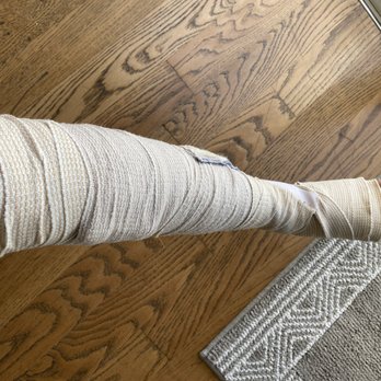 Orange Hill Restaurant & Events - My injured foot - Steakhouses Near Me - Orange, California