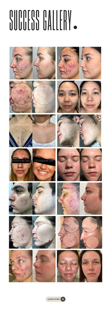 Acne Specialist Marlene Wolfberg Logo