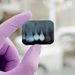Solar Dental - An X-ray at the office