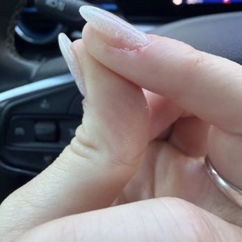 Expo Nails & Spa - broken nail - Nail Technicians Near Me - Lubbock, Texas Expo Nails & Spa - broken nail - Nail Technicians Near Me - Lubbock, Texas