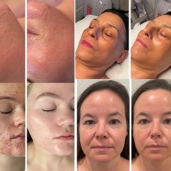 Malka Med Spa - Results