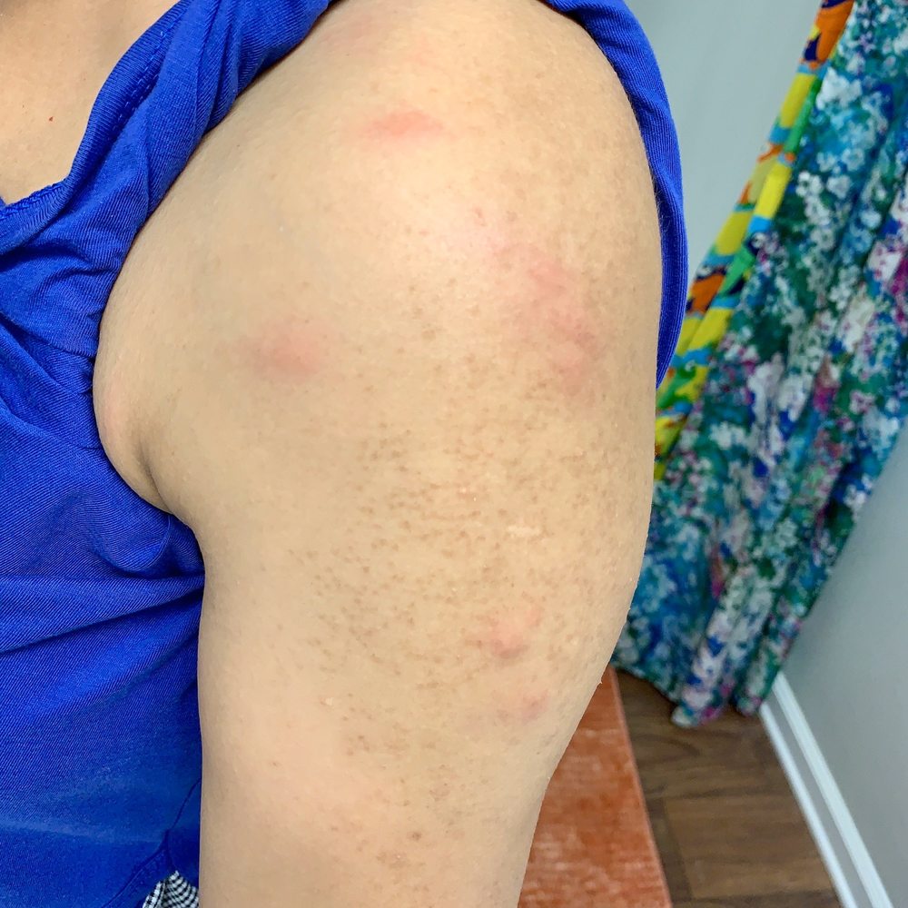 Goodwill - Bedbugs bites - Thrift Stores Near Me - Newbury Park, California