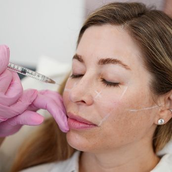 LaserAway - Medical Spas Near Me - Roseville, California