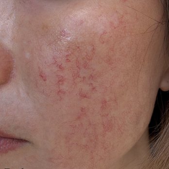 Avalon Laser - Medical Spas Near Me - Carlsbad, California Avalon Laser - Medical Spas Near Me - Carlsbad, California