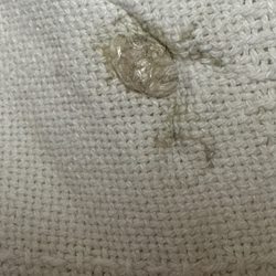 Alaris Health at The Chateau - Dirt from clean blanket