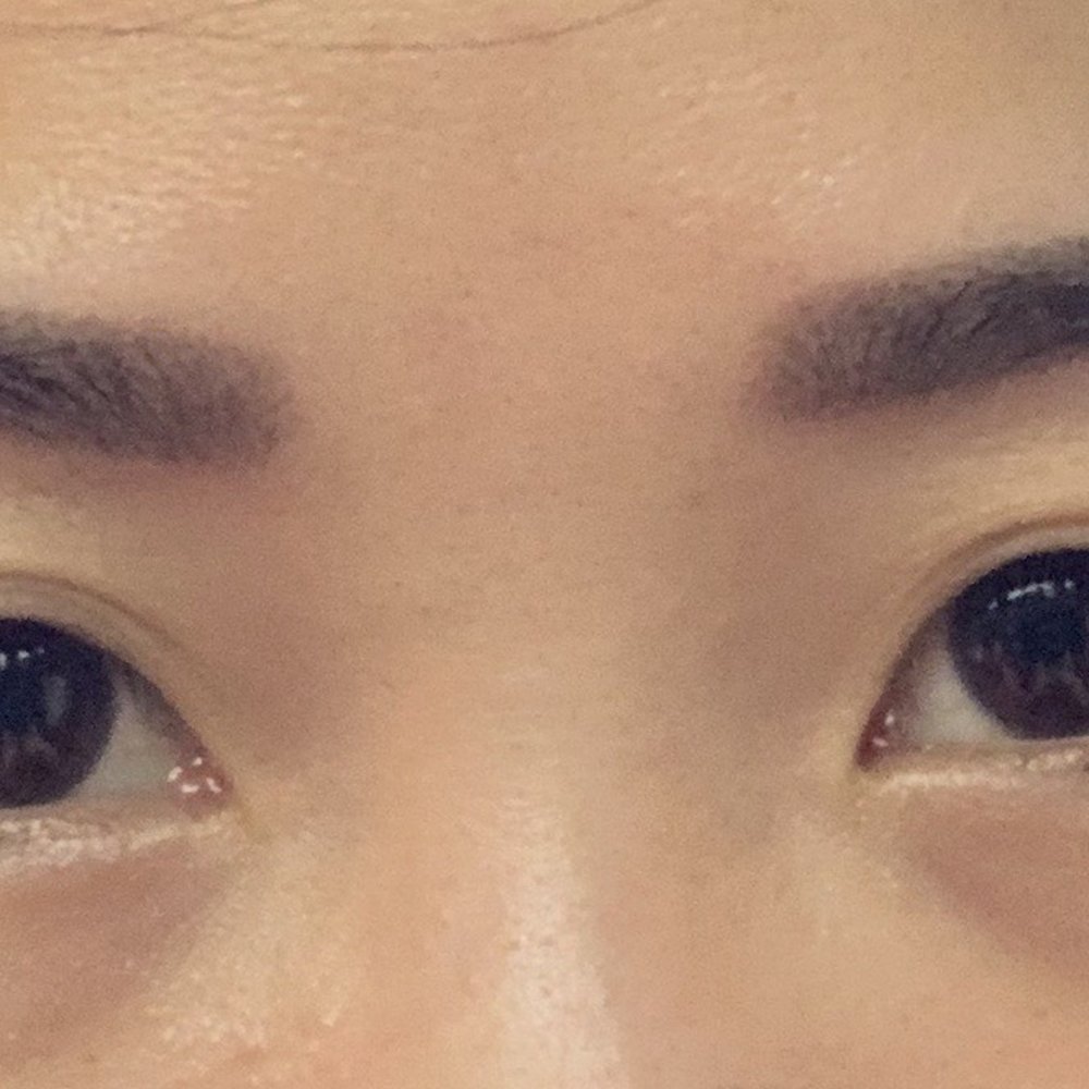 Golden Skin Care Spa - 2 hours after its done - Skin Care Near Me - Flushing, New York