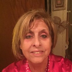 Esther's Skin Care & Electrolysis - Me before treatment