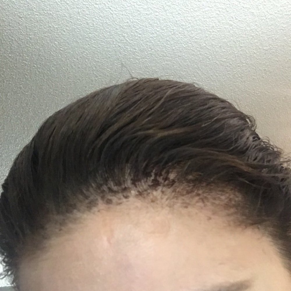Salon Salon - I have balds spots and burns on my scalp due to the chemicals that they use. - Hair Salons Near Me - Tucson, Arizona Salon Salon - I have balds spots and burns on my scalp due to the chemicals that they use. - Hair Salons Near Me - Tucson, Arizona