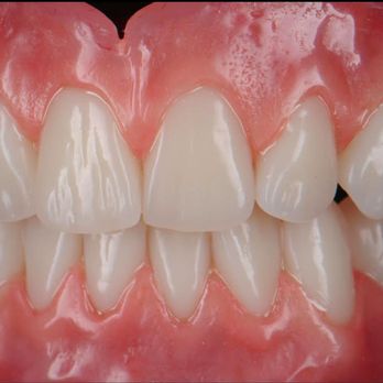 YYC Denture Clinic - [ PREMIUM DENTURES ] At YYC Denture Clinic we offer several types of complete, partial, and implant dentures, each with its own advantages - Health & Medical Near Me - Calgary, Alberta