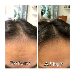 Mo Shop - Hairline and parting SMP