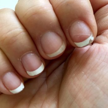 Gel Touch Nail Spa - 3 days after French manicure :( - Nail Salons Near Me - Carlsbad, California Gel Touch Nail Spa - 3 days after French manicure :( - Nail Salons Near Me - Carlsbad, California
