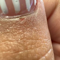 Lux Nails & Spa - The nail lady cut me
