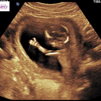 High Risk Pregnancy Center - Henderson - Hello everybody! - Obstetricians & Gynecologists Near Me - Henderson, Nevada High Risk Pregnancy Center - Henderson - Hello everybody! - Obstetricians & Gynecologists Near Me - Henderson, Nevada