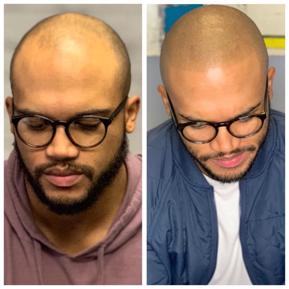 SCALP LOGIC 96 Photos & 17 Reviews 20842 US 59, New Caney, CA Yelp