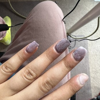Dipped - Chemical burns and contact dermatitis around my cuticles and nails. Currently removing them to avoid a complete flare up. - Nail Salons Near Me - Lake Oswego, Oregon Dipped - Chemical burns and contact dermatitis around my cuticles and nails. Currently removing them to avoid a complete flare up. - Nail Salons Near Me - Lake Oswego, Oregon
