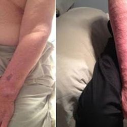 Lymphatic Therapy Services