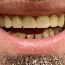 Avid Dental - After