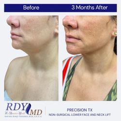RDYMD Medical Spa - Precision tx