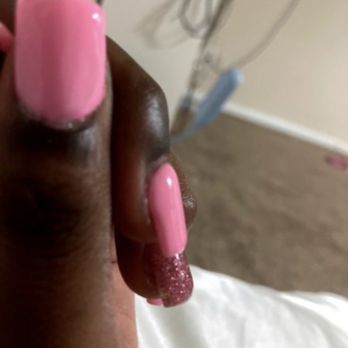 Le Nails Spa - Your can see the flooding cuticles - Nail Salons Near Me - Southfield, Michigan