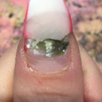 Excellent Nail Spa - Thumb nail full of mold from bad fills ‍ - Nail Salons Near Me - Lancaster, California
