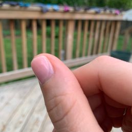Uneven nail polish Uneven nail polish