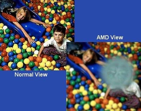 Academy Contact Lens Clinic