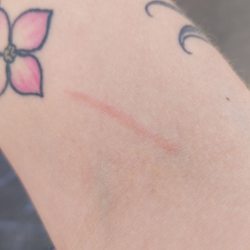 Quest Diagnostics - I had blood drawn here today and was scratched with the needle as it was pulled out.