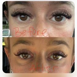 Revive Aesthetics + Wellness - Before and after under eye filler by Elizabeth