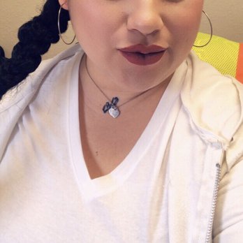 Gallery Plastic Surgery - After lip injections by Dr. Wendy - Cosmetic Surgeons Near Me - Monterey, California