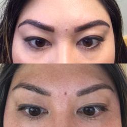 Simitre Beauty - Here's a picture of day after (top) and then after it has healed (bottom)