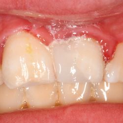 Capitol Endodontics - Fixed