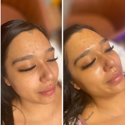 Renew Med Spa & Cryotherapy