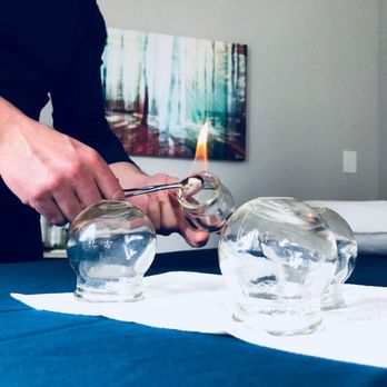 Jova Acupuncture - Traditional fire cupping. - Acupuncture Near Me - Tenafly, New Jersey Jova Acupuncture - Traditional fire cupping. - Acupuncture Near Me - Tenafly, New Jersey