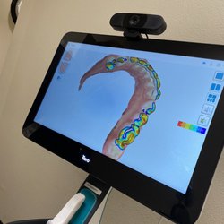 Smile Vegas Dental - 3D model scan of your mouth/teeth